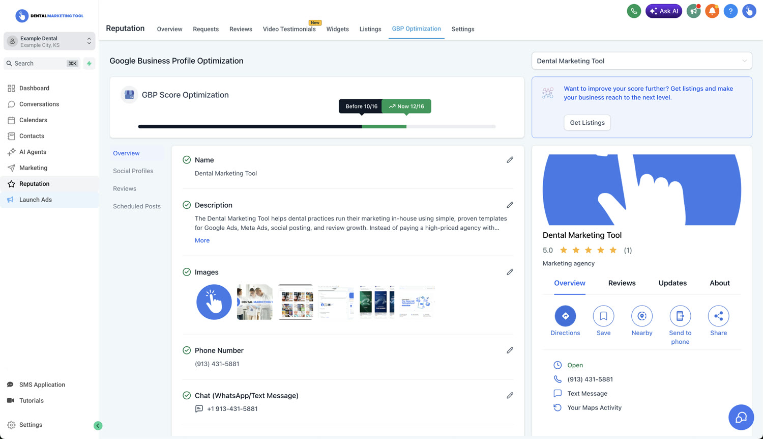 Dental Marketing Tool AI Google Business Profile optimization score rising